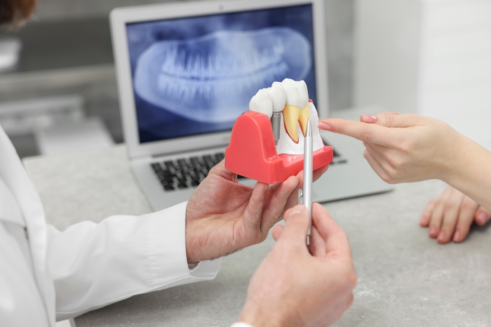 Irvine Dental Implants: Implant Model Reviewed Alongside a Digital X-Ray Dentist reviewing a dental implant model alongside a digital X-ray in Irvine, CA