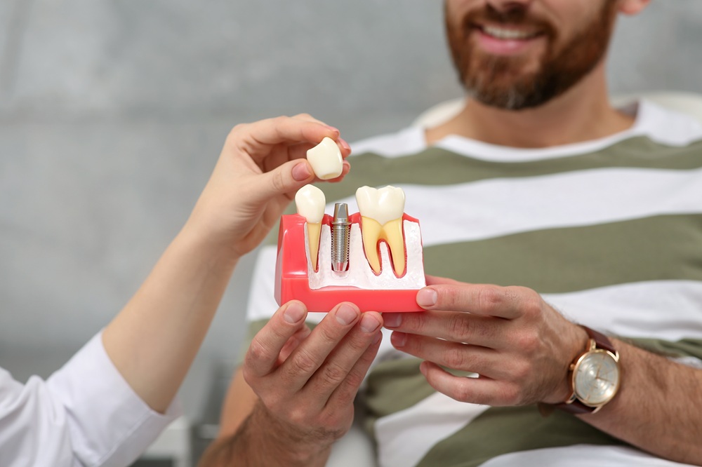 Irvine Dental Implants: Reviewing an Implant and Crown Model Irvine dental patient examining an implant and crown model during his consultation